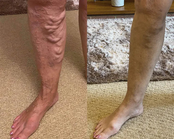 Antes y después