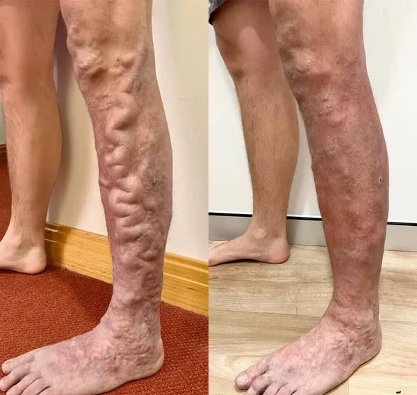 Antes y después